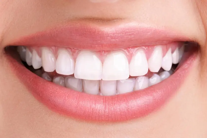 smiling image of a girl showing white teeth 